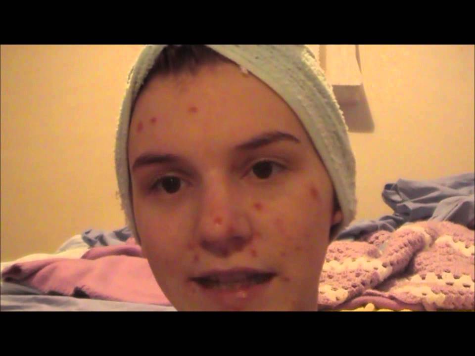 Dermatillomania - My video to Dr. Phil