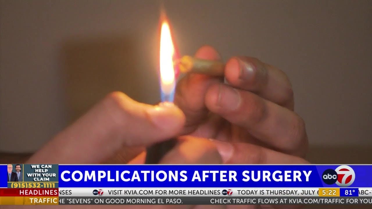Overuse of marijuana linked to surgery complications and death, study says