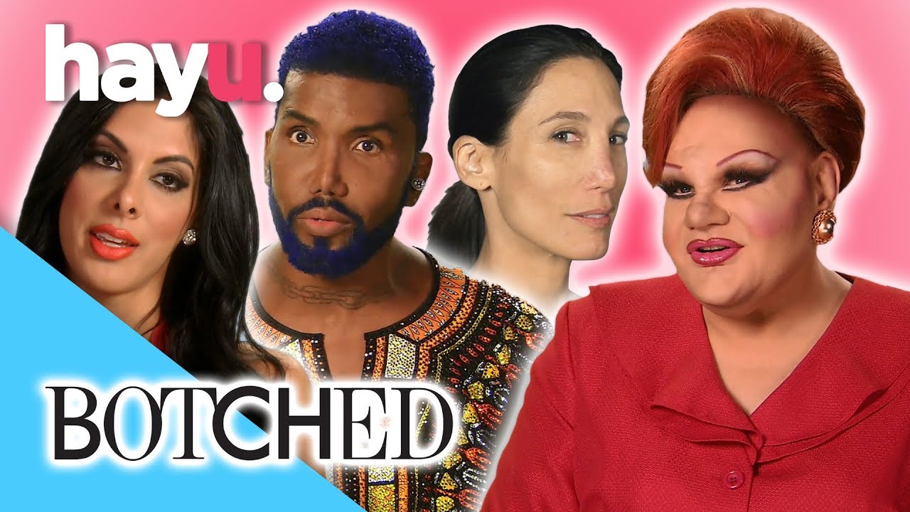 Worst Nose Jobs Fixed! Before & After Compilation | Botched