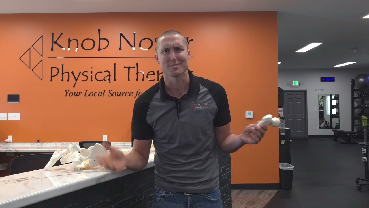 Avascular Necrosis of the Hip