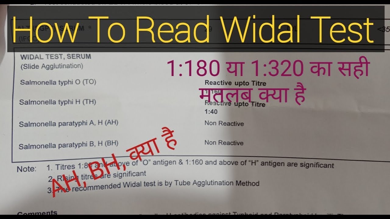 Widal Test | How To Read Widal Test Report (Enteric Fever Report) | विडाल टेस्ट / Dr Lokendra