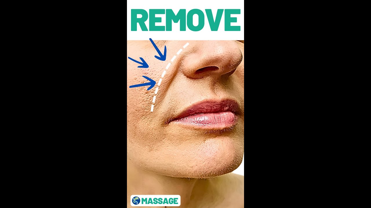 Eliminate nasolabial folds with daily massage