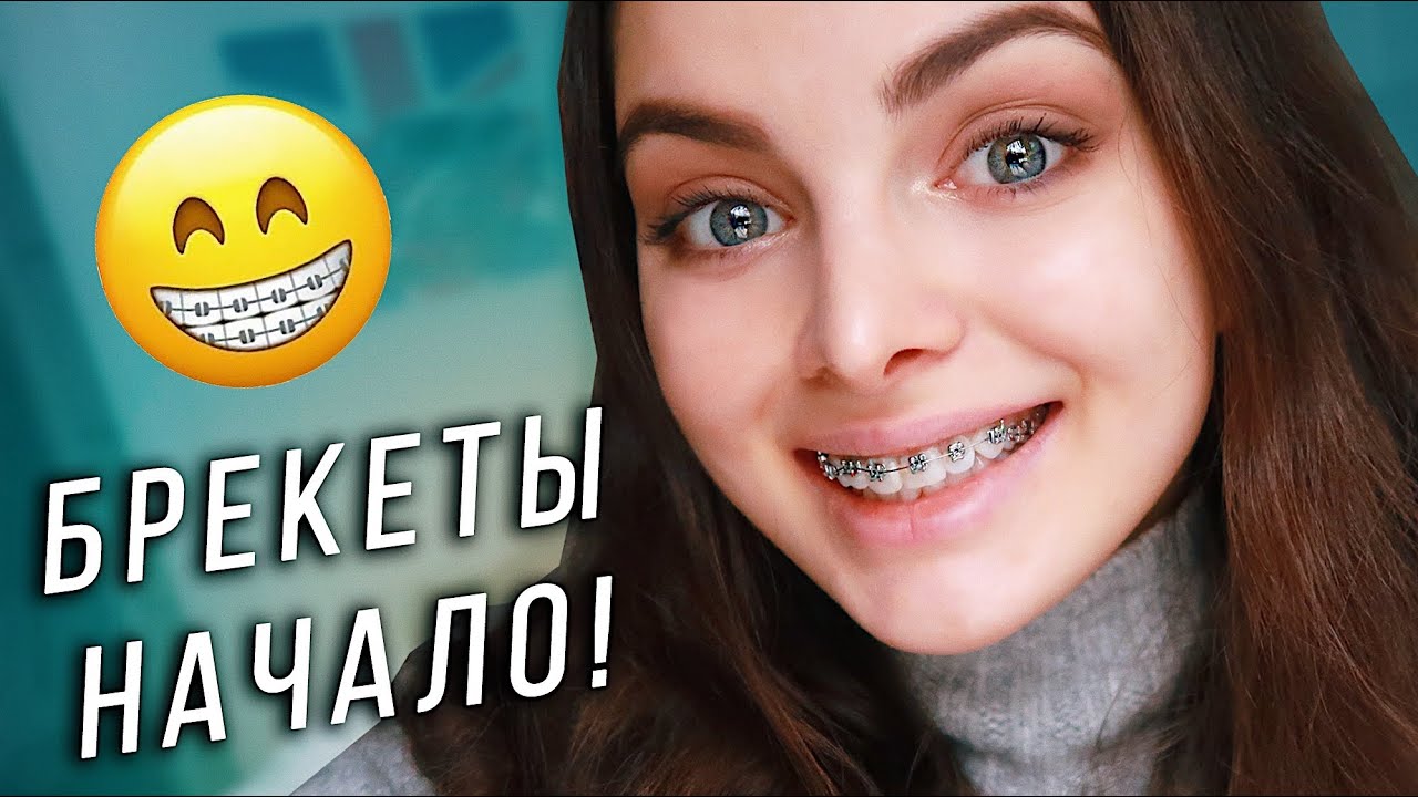 ПОСТАВИЛА БРЕКЕТЫ! Первые ощущения и боль! 😬😱