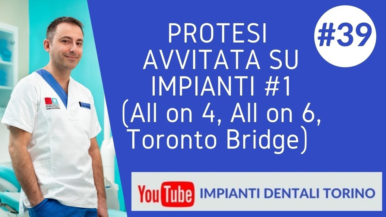 video 39 PROTESI AVVITATA SU IMPIANTI   ALL ON 4  ALL ON 6  TORONTO BRIDGE   IMPIANTI DENTALI TORINO