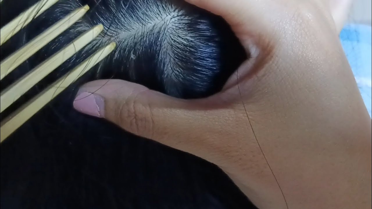 ASMR Scalp Scratching