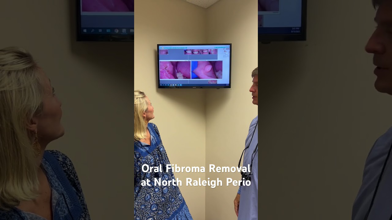 FIBROMA REMOVAL WITH LASER 🚀🔬 DR. SINGLETARY DISCUSSES WITH HIS NIECE