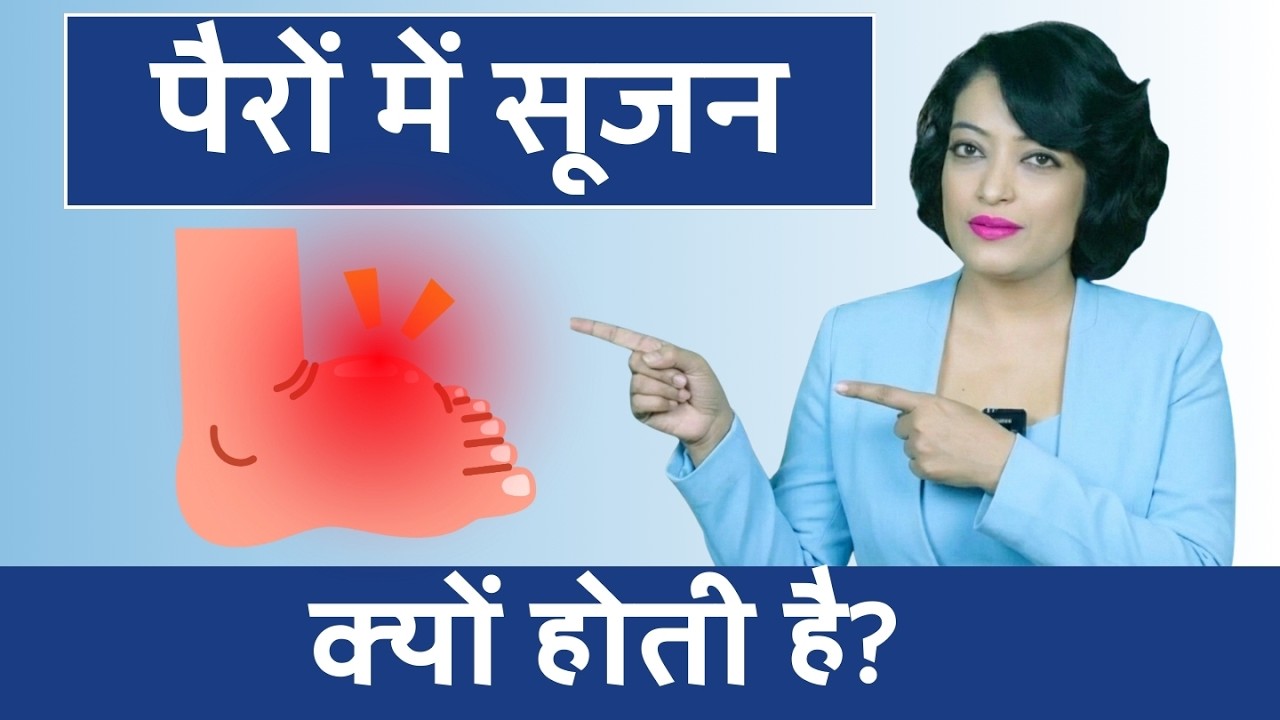 पैरों में सूजन क्यों होती है? Edema Causes Explained