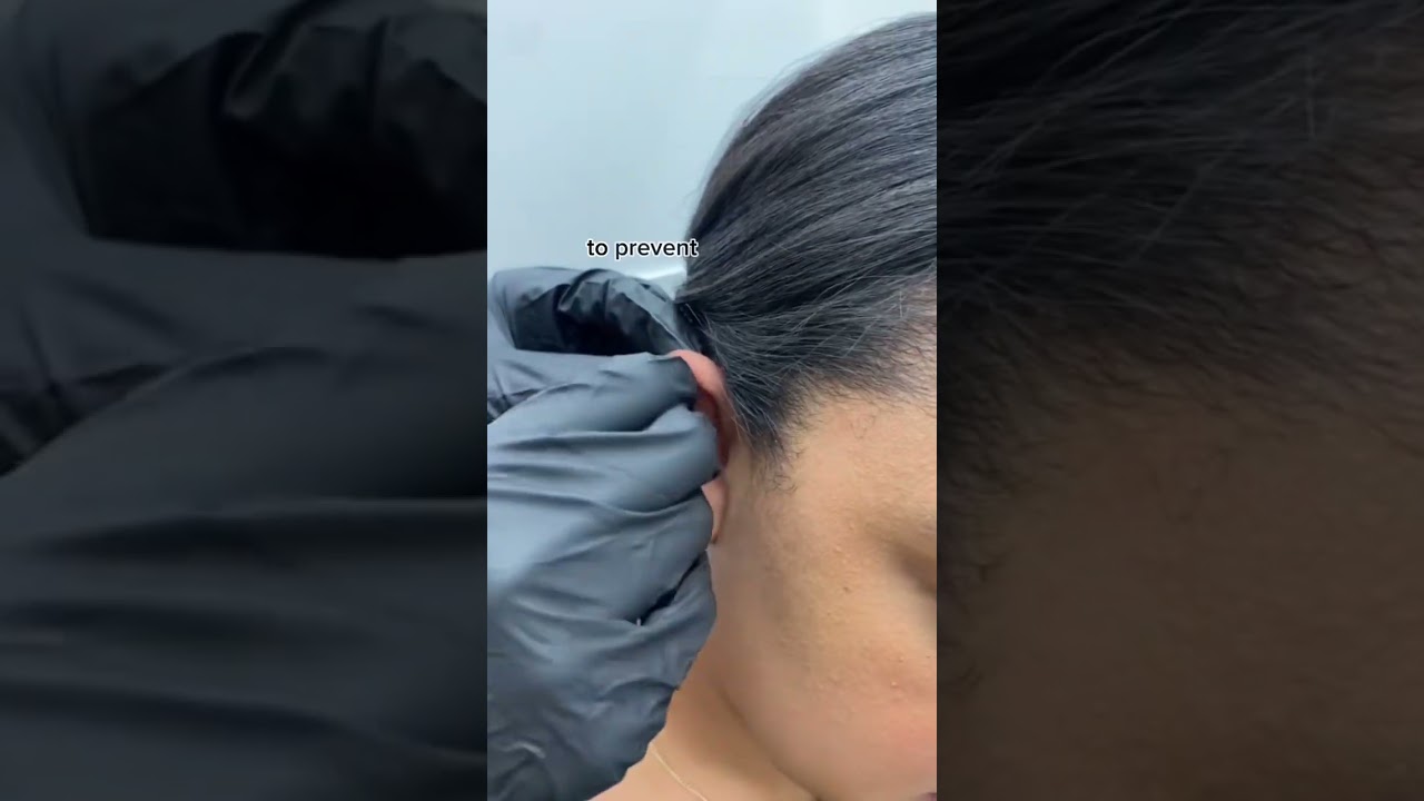 Replacing the size of your post can change your ear healing process for the better! 🤩 Are you in nee