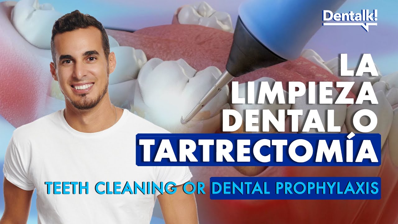 ¿Van a hacerte una LIMPIEZA DENTAL? Esto necesitas saber sobre la TARTRECTOMÍA | Dentalk! ©