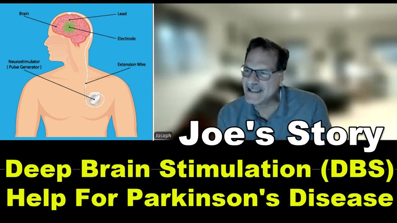 Parkinson's disease treatment: Adaptive Deep Brain Stimulation (aDBS).