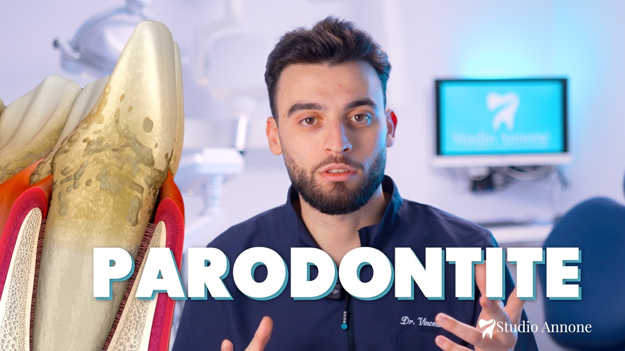 Parodontite: la malattia silenziosa che mette a rischio il sorriso | Dr. Vincenzo Annone