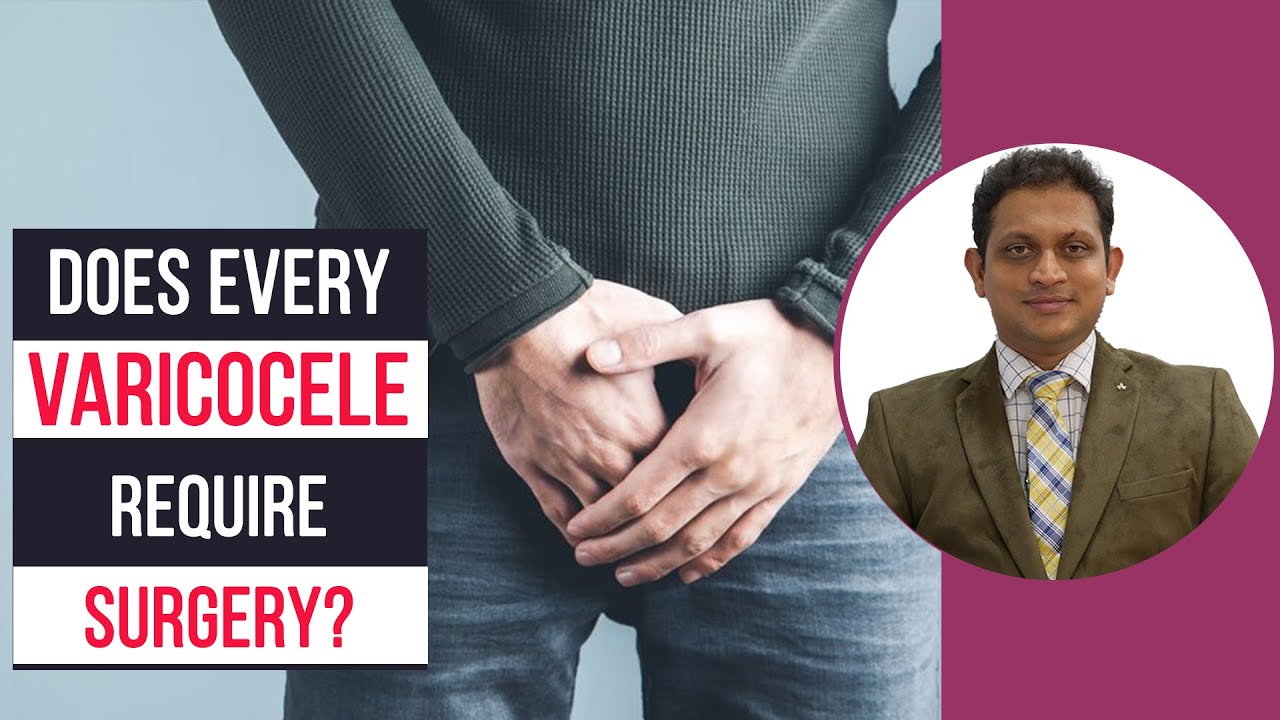 M3 Does every varicocele requires surgery ?