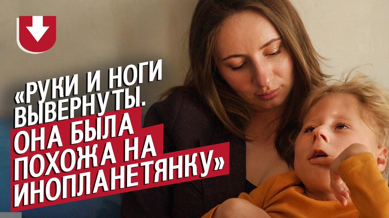 У моей дочери синдром Кагами-Огата: Ольга | Быть мамой