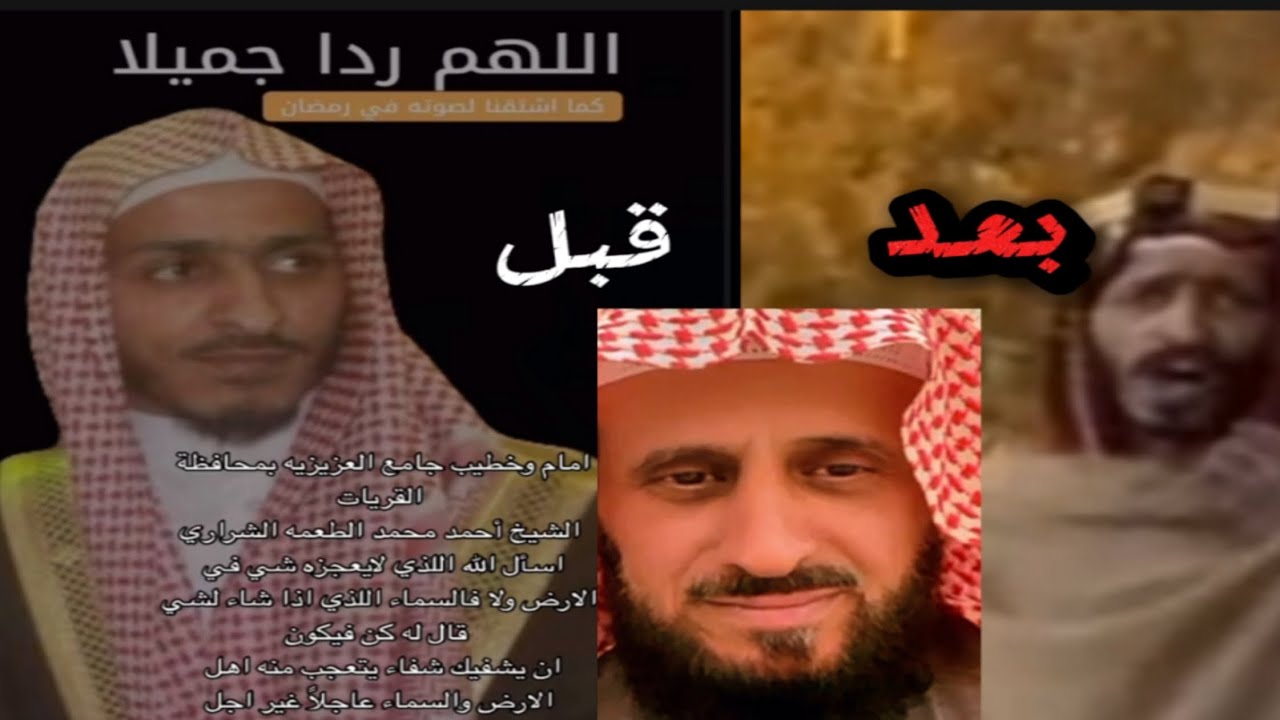 الشيخ احمد الطعمه الشراري فقد عقله بسب هذا السحر وربما هذا السبب ولو كان إمام وحافظ لكتاب الله