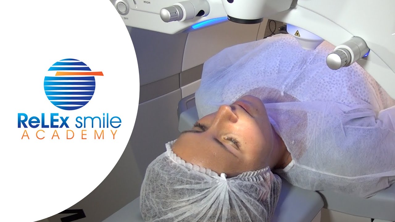 ReLEx smile Academy: Lenticule creation Step 1 to 4