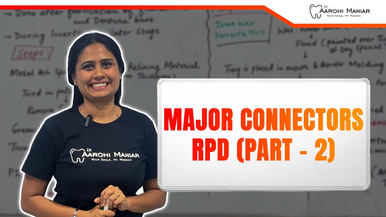 Major Connectors RPD часть 2