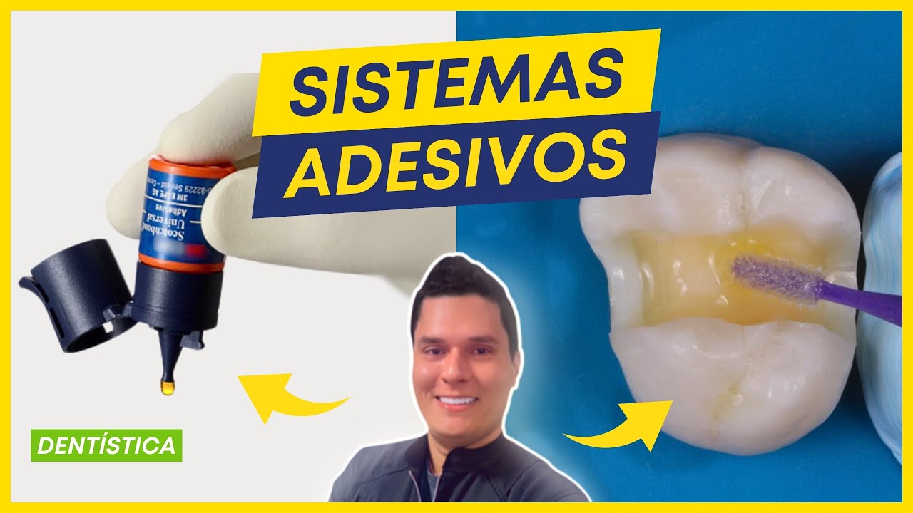 PRINCIPAIS SISTEMAS ADESIVOS EM ODONTOLOGIA / DENTÍSTICA