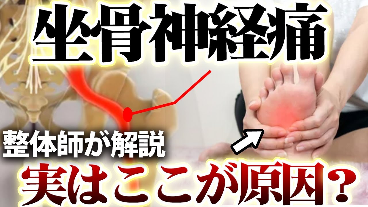 坐骨神経痛は足裏で解消！？見るだけでわかる仕組みと原因！