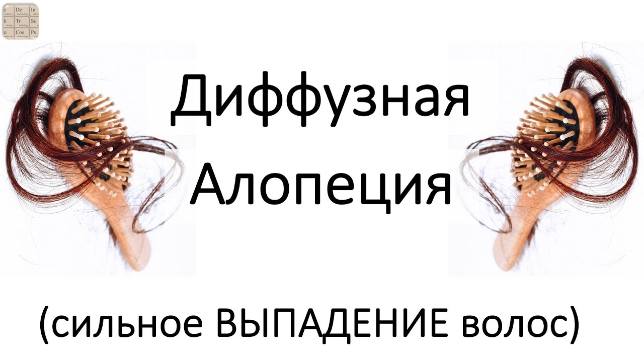 Диффузная алопеция (очень сильное ВЫПАДЕНИЕ ВОЛОС)