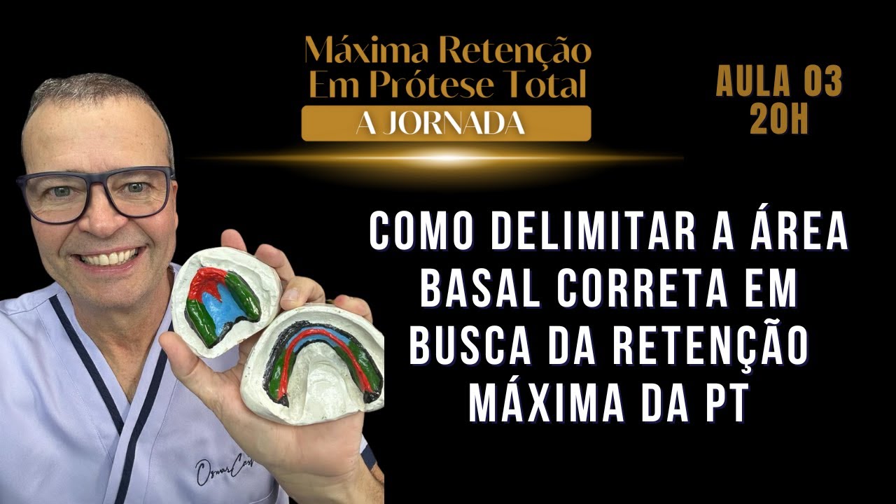 Delimita&ccedil;&atilde;o da &aacute;rea basal em pr&oacute;tese total