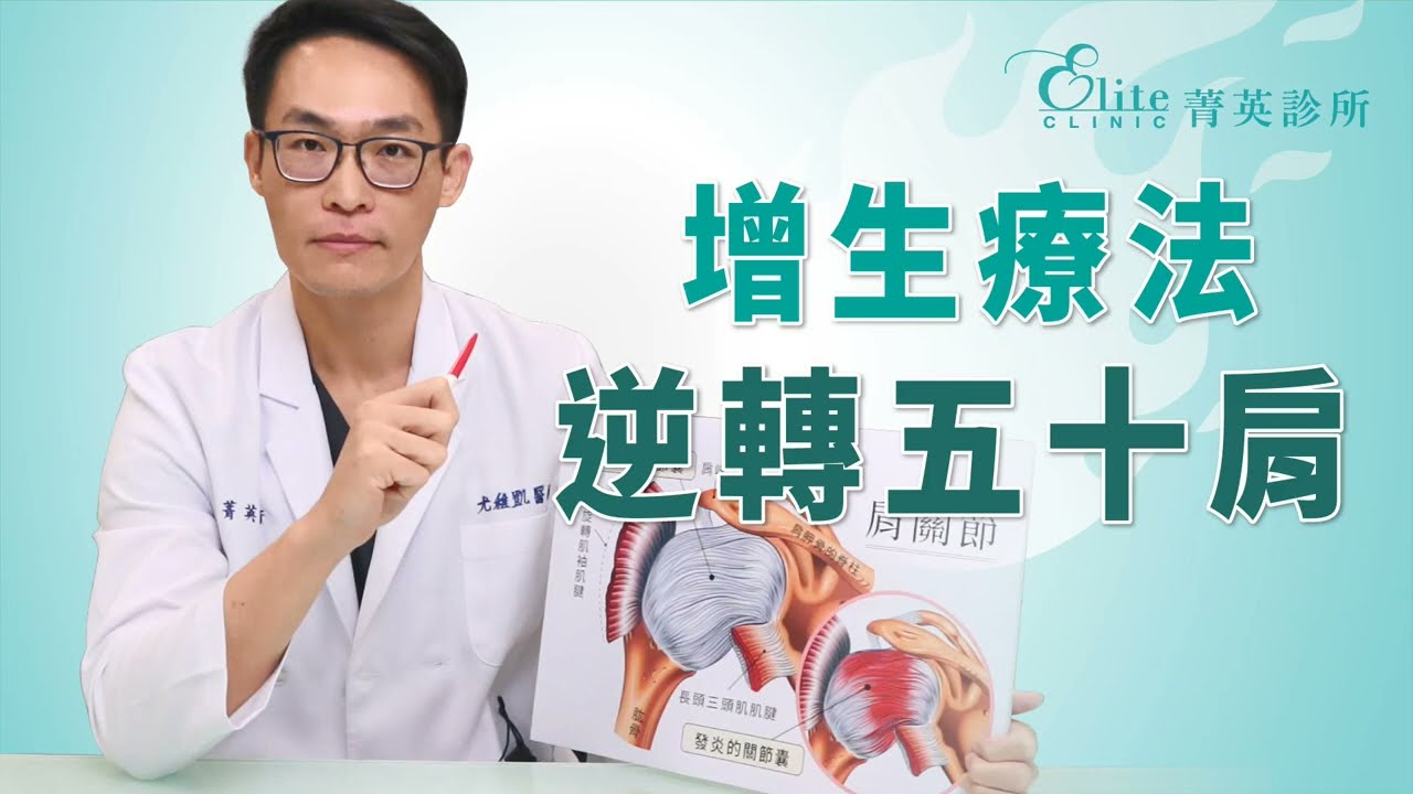 增生療法逆轉五十肩｜尤稚凱醫師
