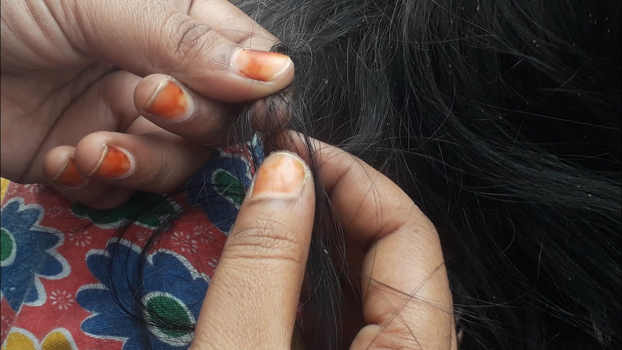 Nitpicking by short hair with her mother hands/real sounds Nitpicking telugu @PR Nitpickingchannel