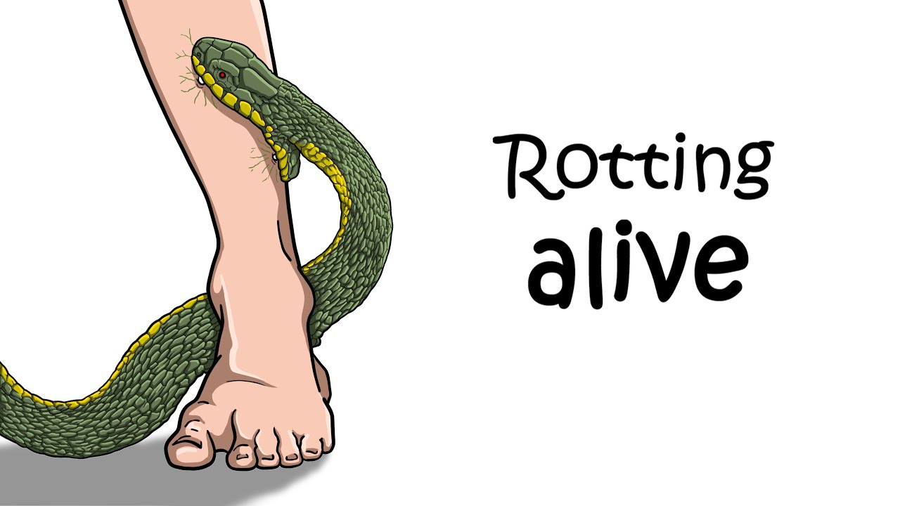 Your last hour after a deadly snake bite