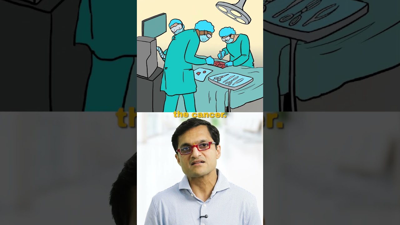 Surgery or Transplant for Liver Cancer? Here's How We Decide. #surgery #transplant #livercancer