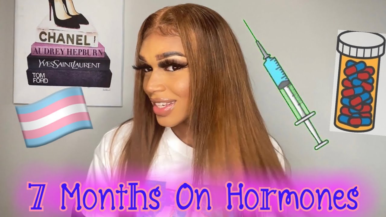 7 Month Hormone Update | Transgender Q&A