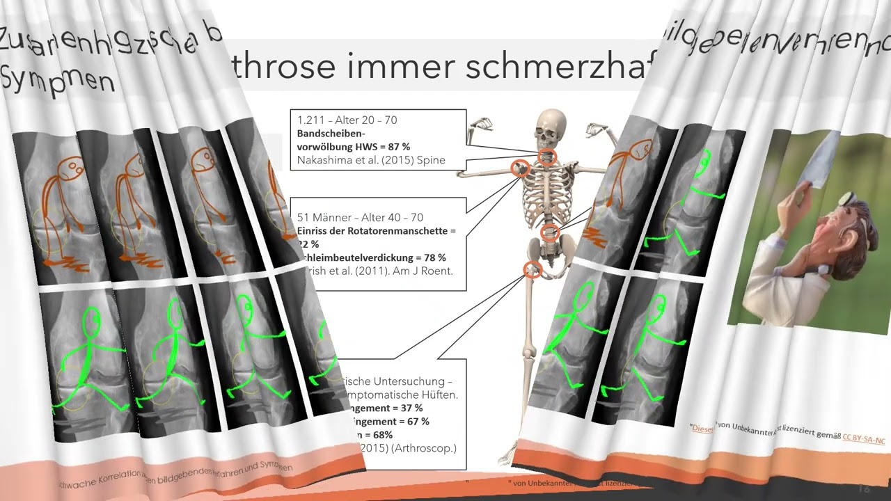 Trainingsprogramm Arthrose Patienten-Information
