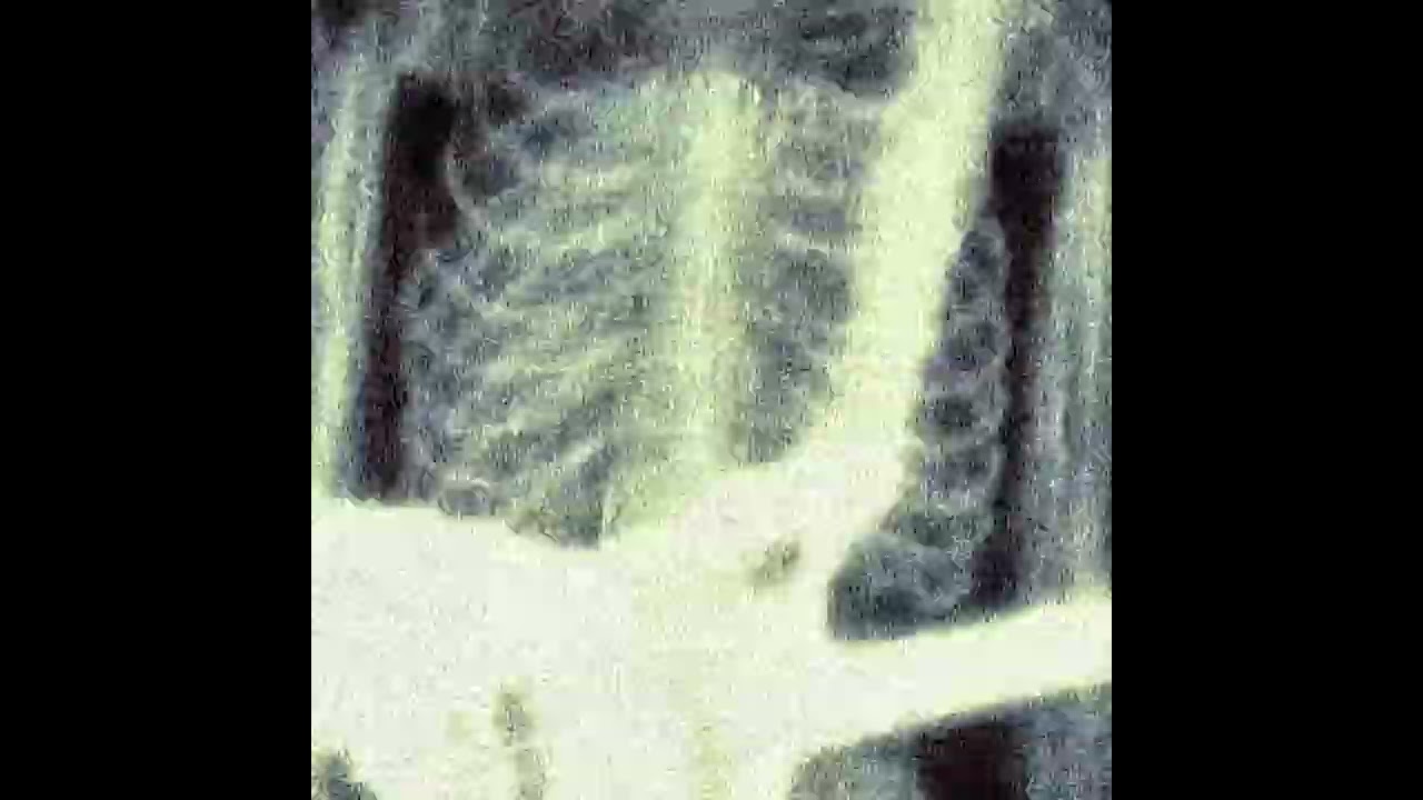ตลอดไปไม่มี - MULTIEXPOSURE (Official Audio)