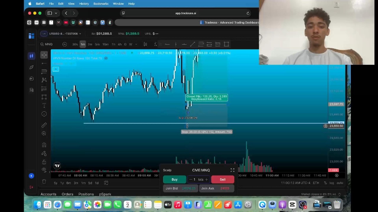 19 Year Old Makes Easiest +$1400 Trading