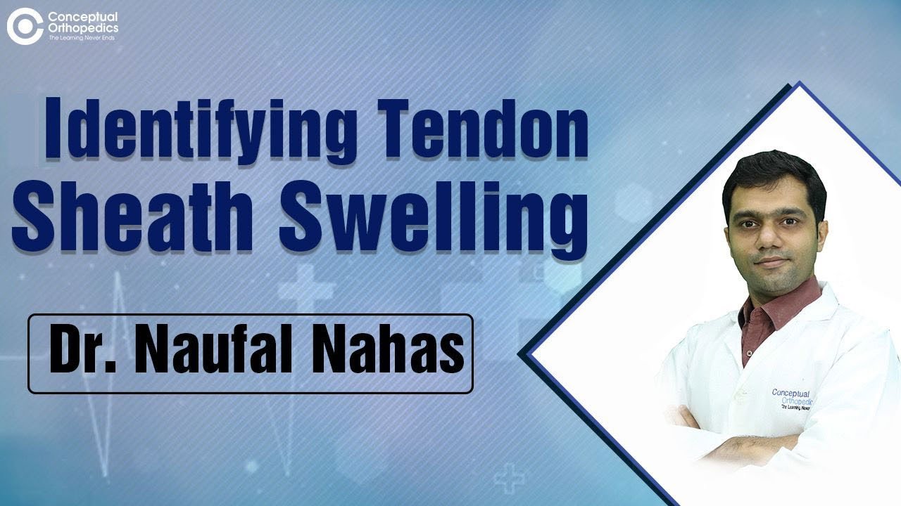 Identifying Tendon Sheath Swelling by Dr. Naufal Nahas @ConceptualOrthopedics