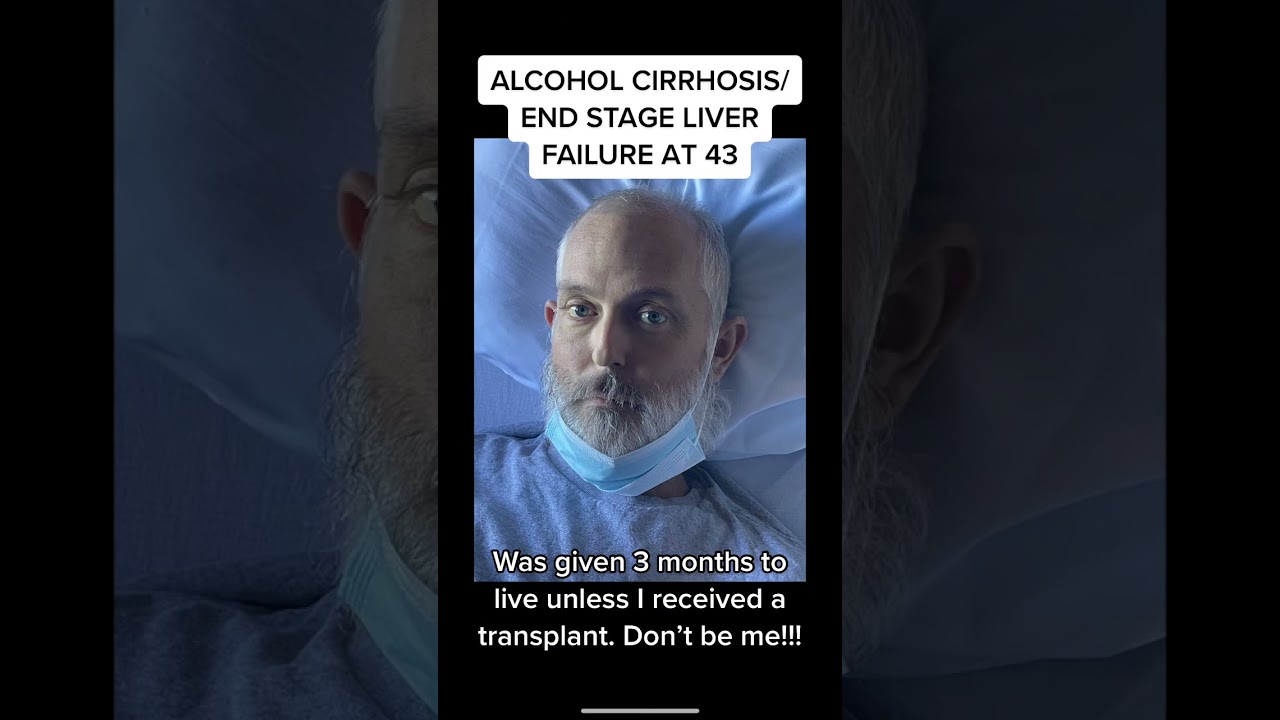 Liver Health Awareness: Cirrhosis, Alcohol, and Transplants #alcohol #cirrhosis