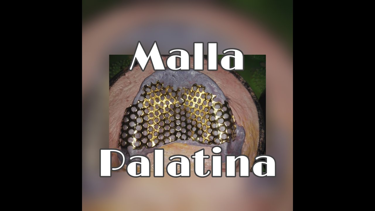 Malla palatina Adaptación