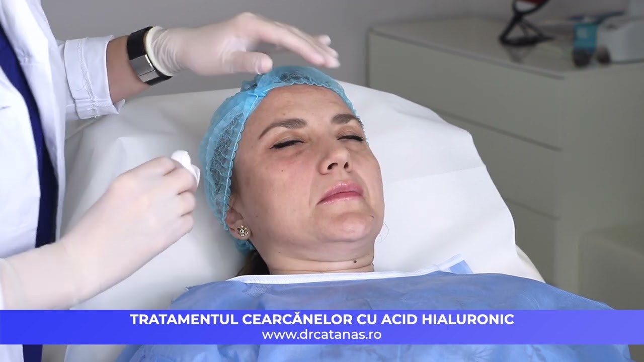 Tratamentul cearcănelor cu acid hialuronic