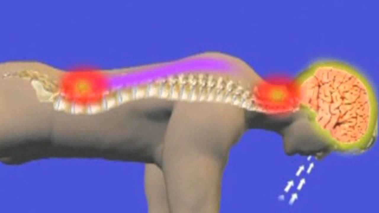 Dr. Michael Whelan on Network Spinal Analysis