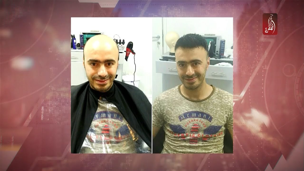 تركيب الشعر ، محمد شخيص يحدثنا عن احدث تقنياته و صيحاته | مساء الامارات 16-04-2018