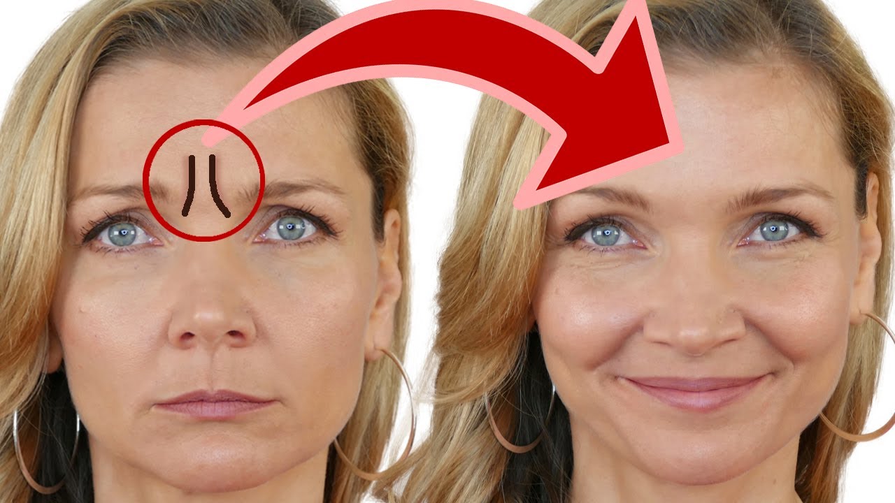 DER Trick, um Zornesfalten zu mindern (kaum bekannt) + Gua Sha
