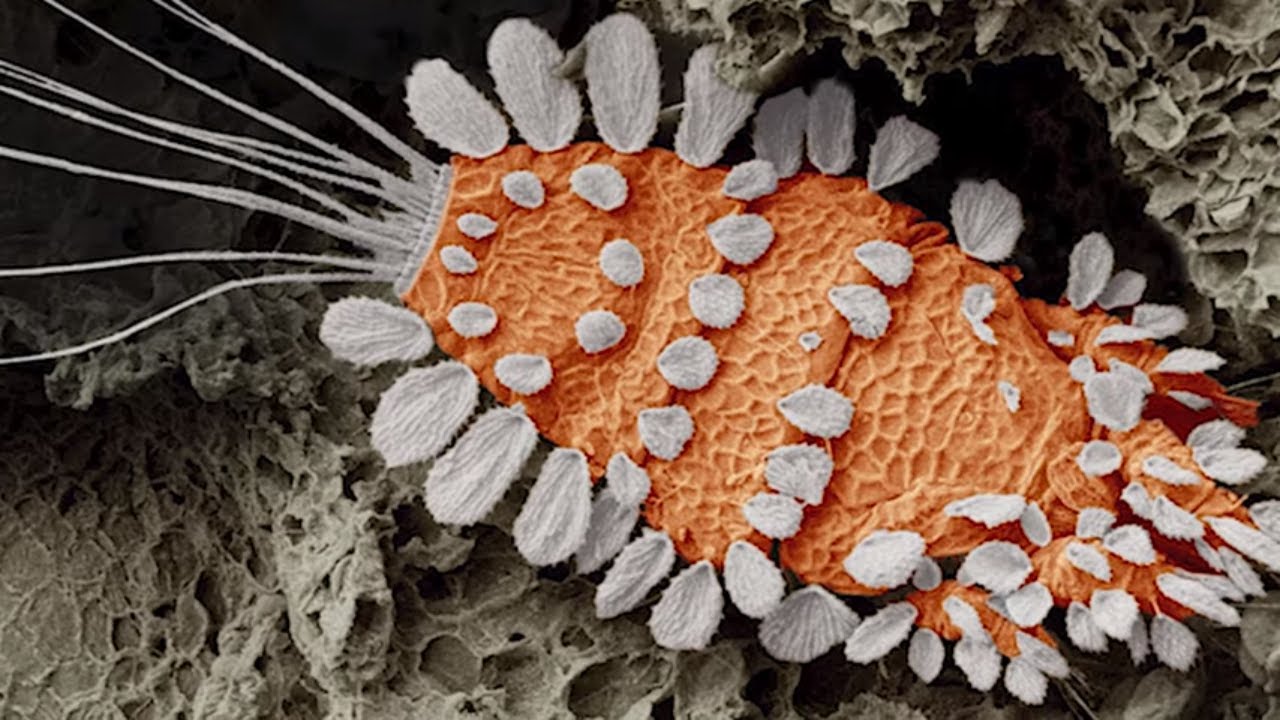 16 Scary Microscopic Monsters