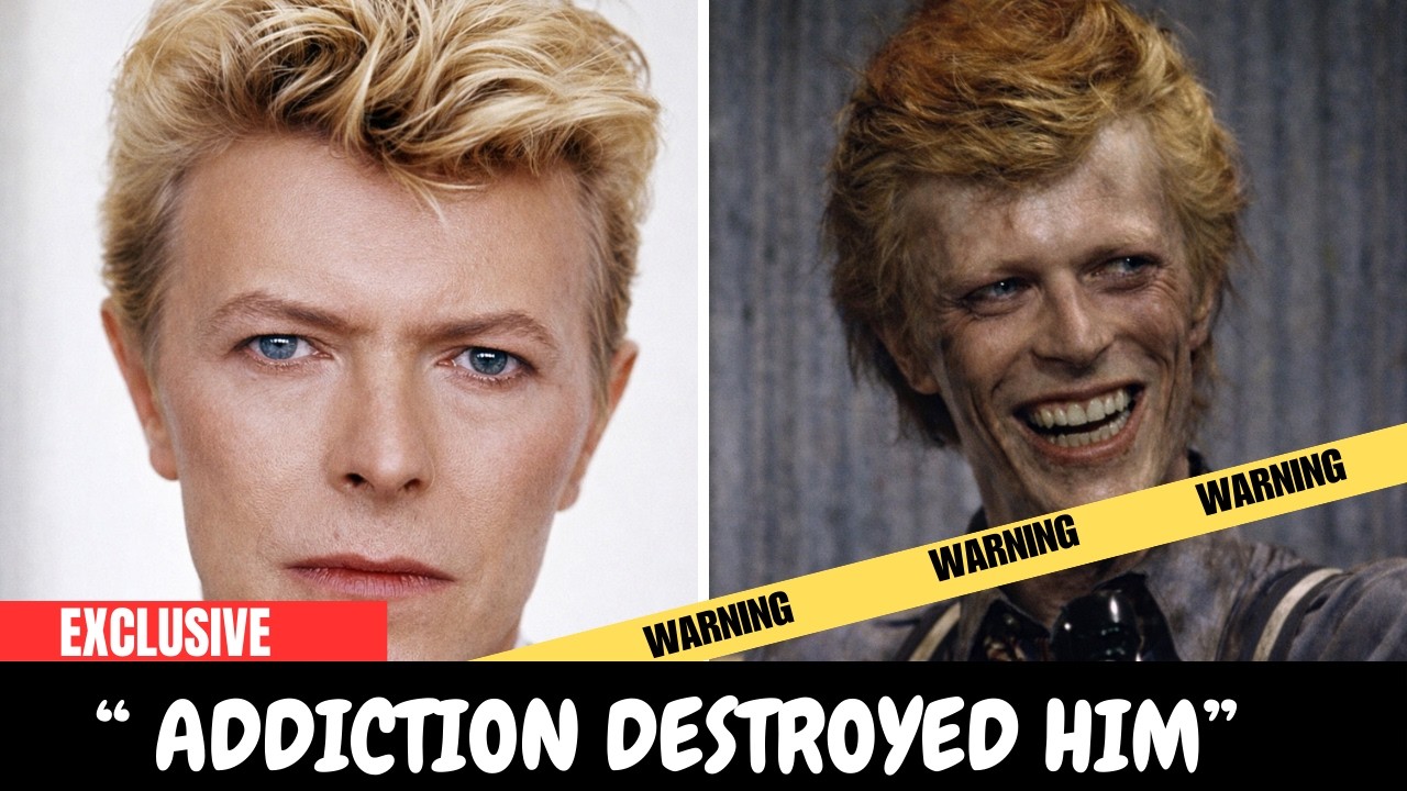 10 Worst Junkies in Pop History — The Untold Secrets