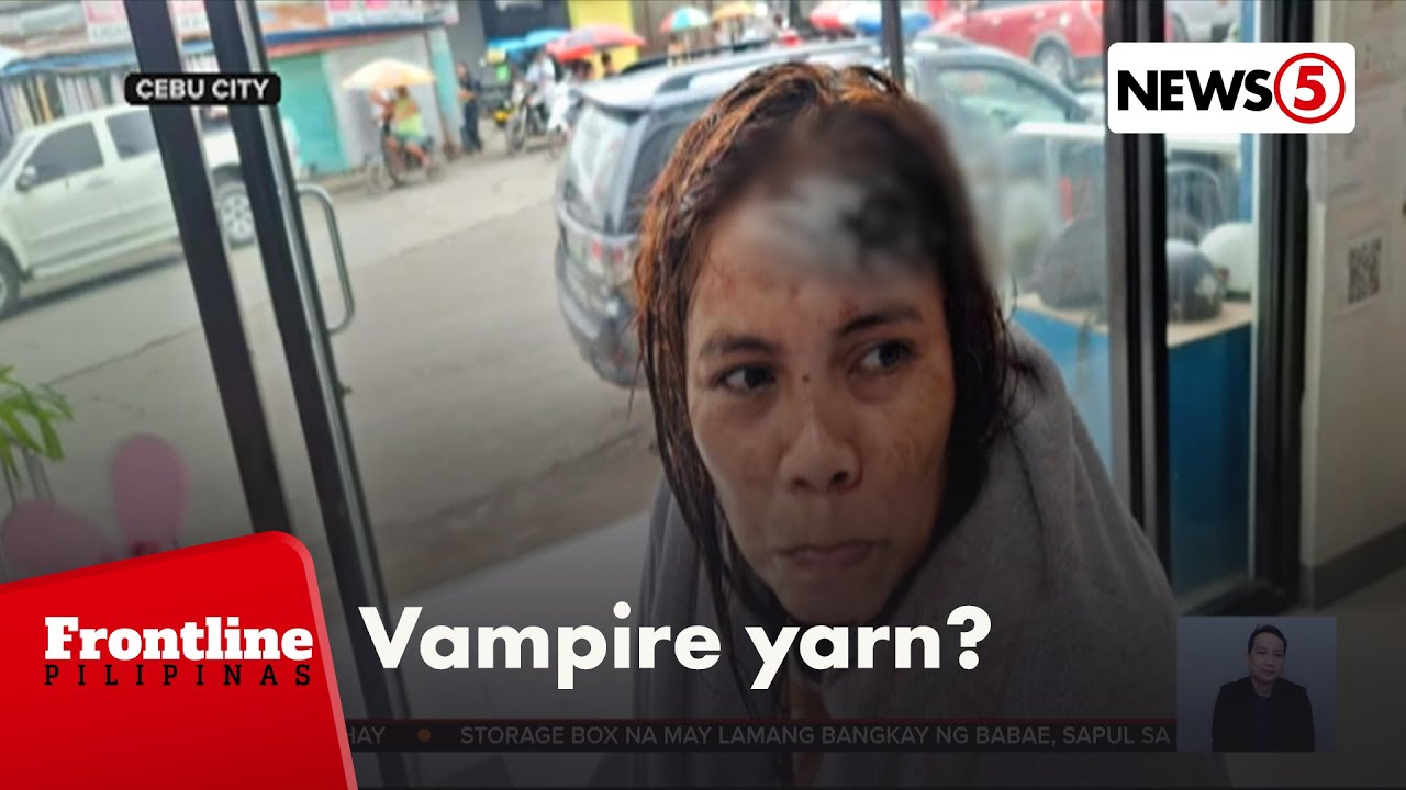 Manikyurista, tuklap ang balat sa noo matapos kagatin ng nakaalitang kapitbahay