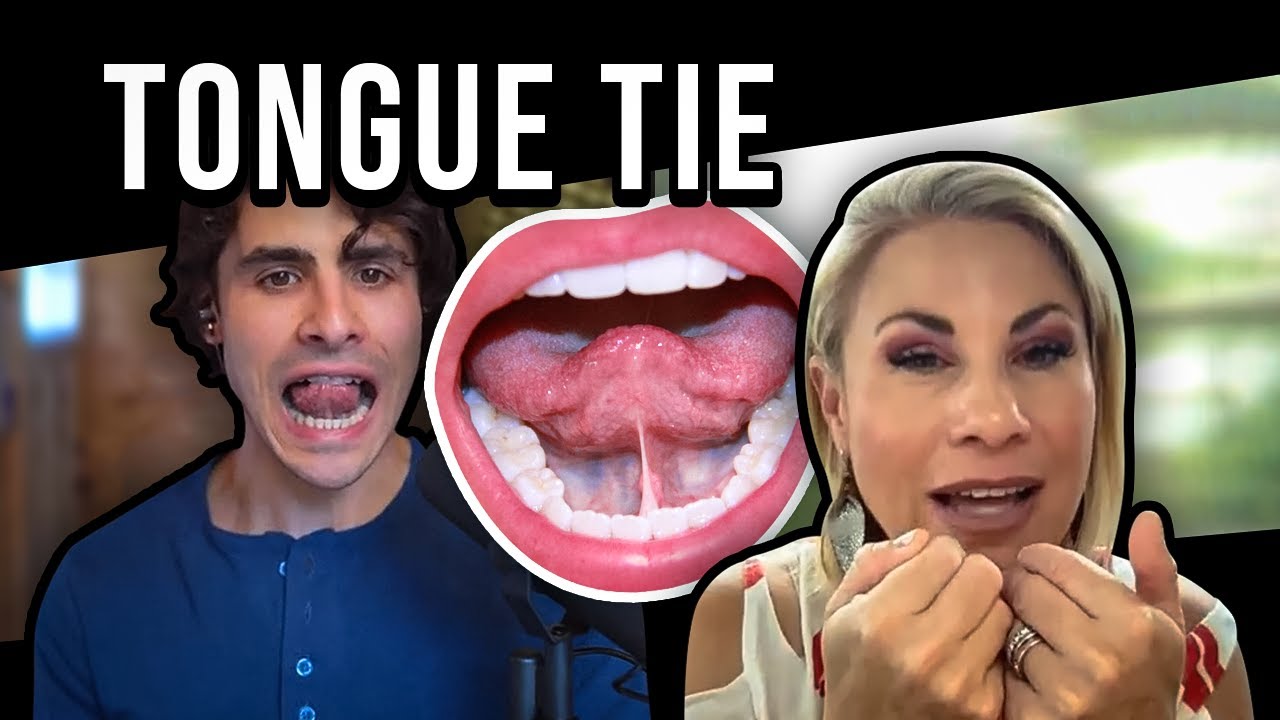 Is Your Tongue Holding You Back? - Tongue Tie Evaluation
