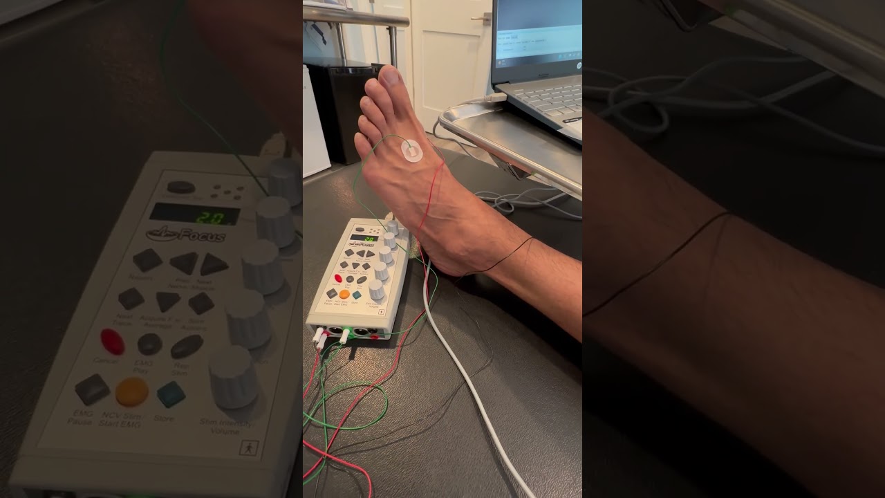 #NCV Lower leg testing sequence with Dr. Mark Gabriel @thewellnesscenterpdxmarkga8951