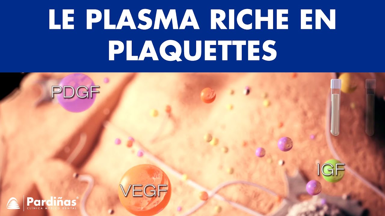 PRP - Plasma riche en plaquettes ©