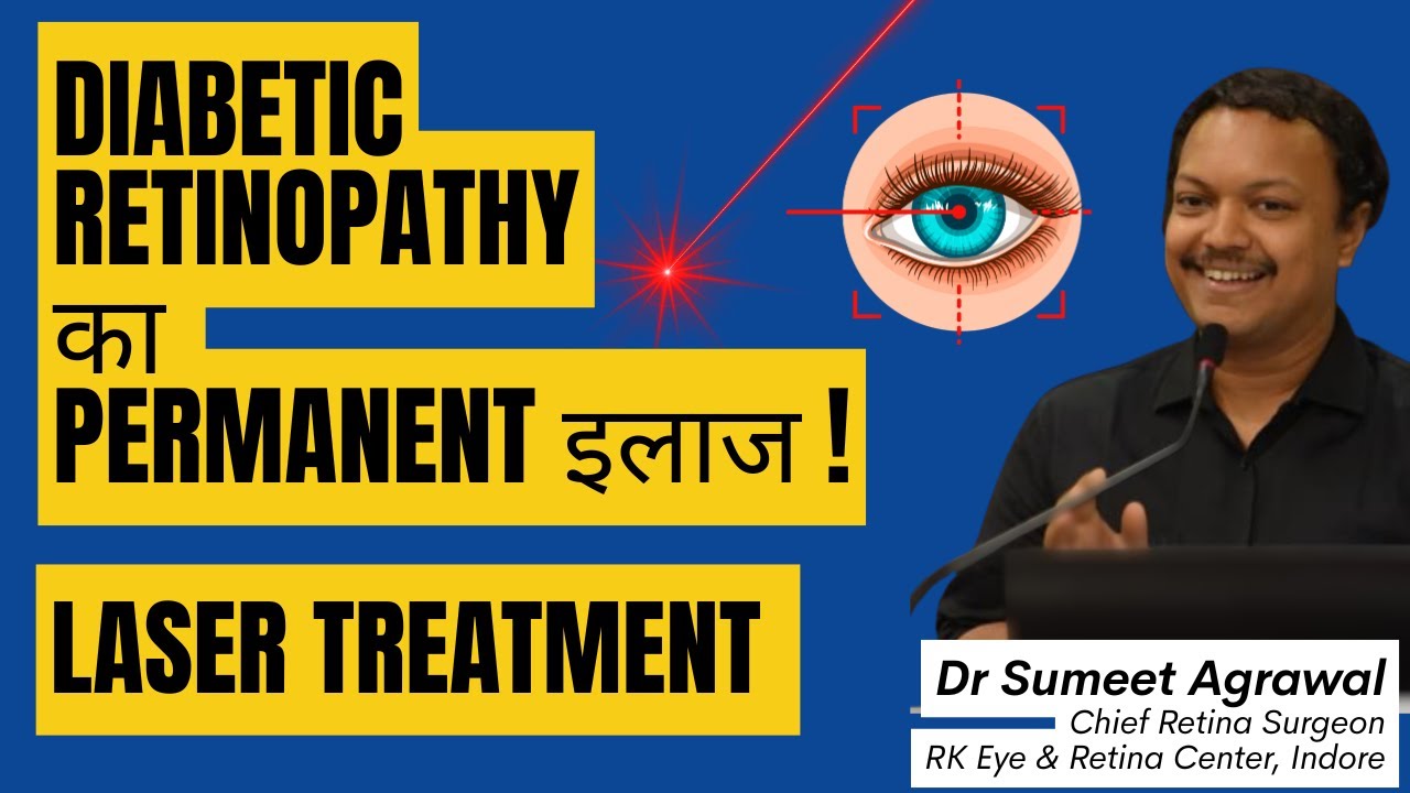 Diabetic retinopathy का LASER से TREATMENT !