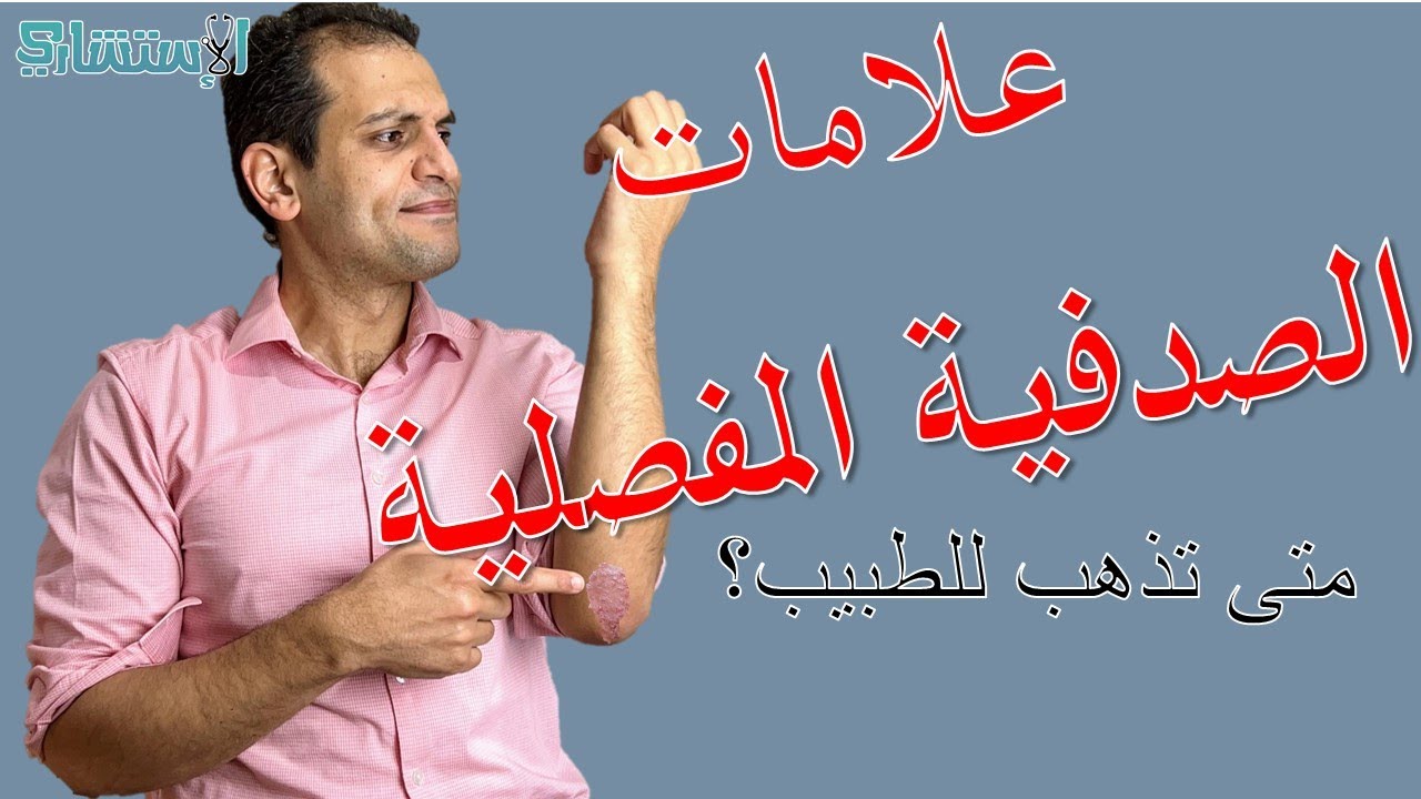 أعراض الصدفية المفصلية وكيفية التشخيص | الاستشاري