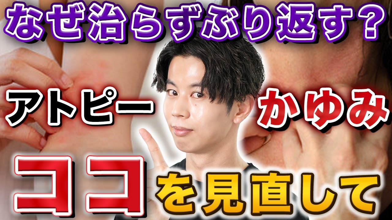 【徹底解説】カサカサ・かゆみ‥ぶり返すアトピーを改善するために見直すべきポイントとは？