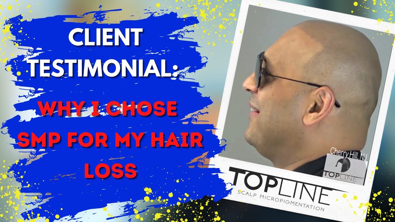 Scalp Micropigmentation Review | TOPLINESMP