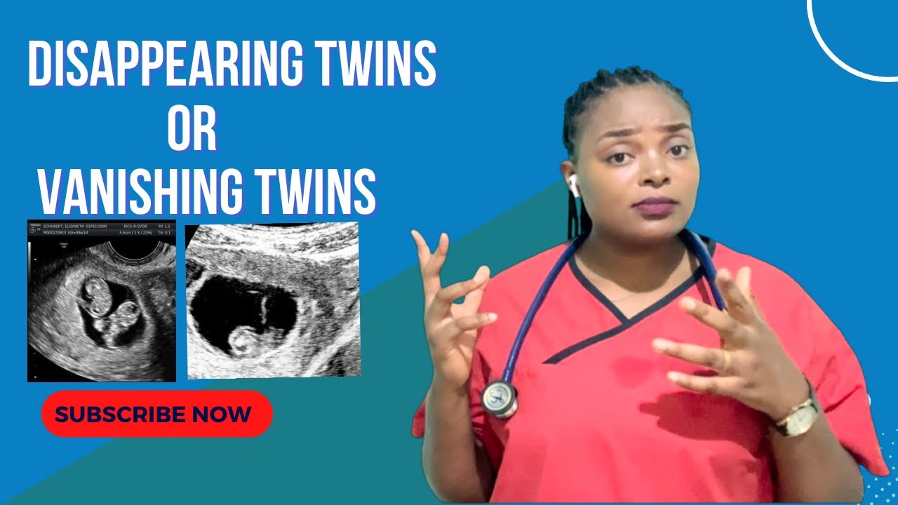 VANISHING TWINS SYNDROME: What happens and what can be done?